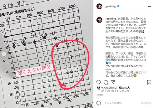 GENKING メニエール症 内リンパ水腫