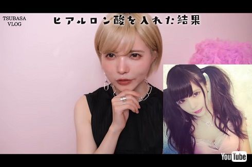 益若つばさ 整形 告白 美容