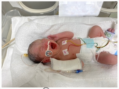 光上せあら 第2子 出産 妊婦 新型コロナ SDN48 ブログ