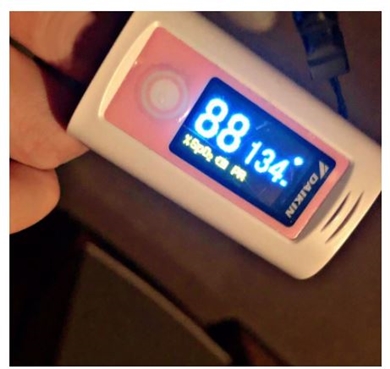 広田レオナ 肺がん ワクチン 現在 療養