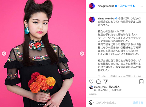 海音 義足 モデル 蜷川実花 東京 パラリンピック 開会式 閉会式 五輪