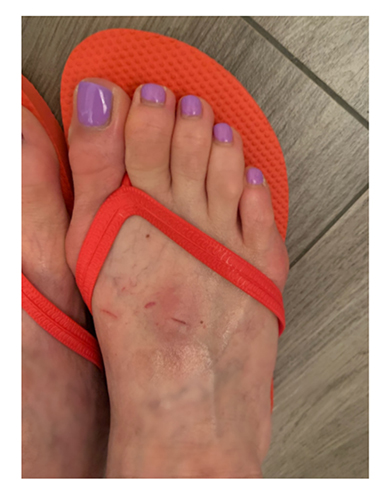 武田久美子 アクシデント 大クラッシュ