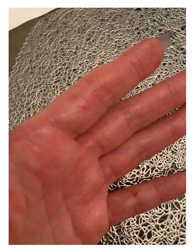 武田久美子 アクシデント 大クラッシュ