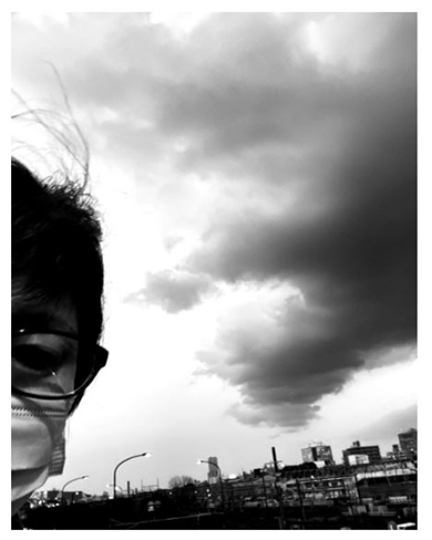 古村比呂 がん リンパ浮腫 現在 治療