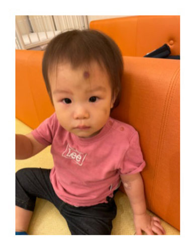 はんにゃ 川島章良 難病 特発性血小板減少性紫斑病