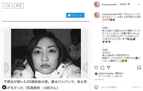 山田まりや 病気