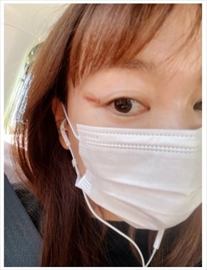 保田圭 モーニング娘。 ブログ ケガ 目