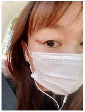 保田圭 モーニング娘。 目元 ケガ 治療 傷跡 ブログ