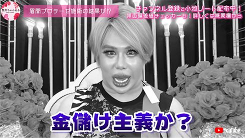 アレン 整形 整形男子 YouTube 体験談 プロテーゼ 眉間