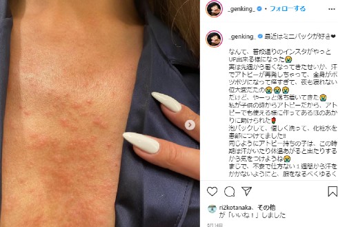 GENKING 盲腸 腹膜炎 人間ドック ジュノンボーイ 同性愛 タレント LGBT