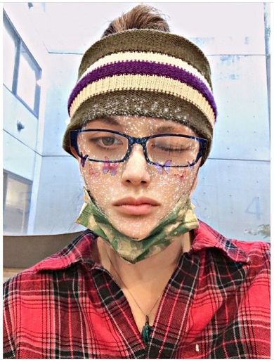 広田レオナ 股関節 炎症 女性ホルモン