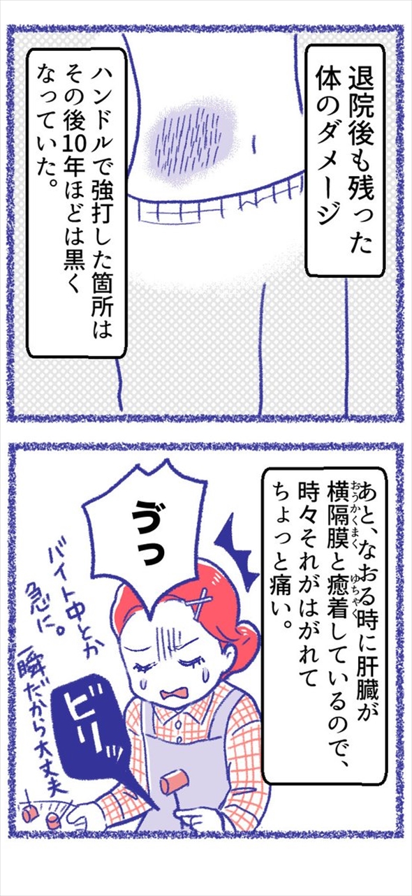 事故 やぶ医者 漫画