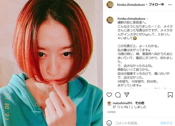 島袋寛子SPEED鼻整形疑惑悩み