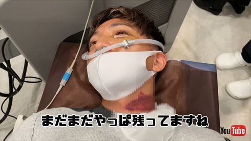 朝倉未来 後藤祐樹 1000万円 ストリートファイト タトゥー 除去 手術 YouTube