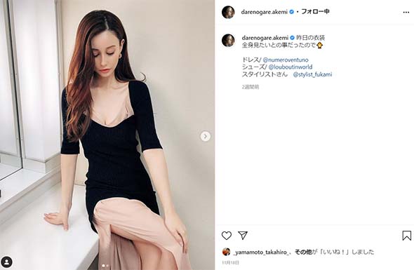 ダレノガレ明美 モデル タレント ダイエット 減量 増量フジテレビ