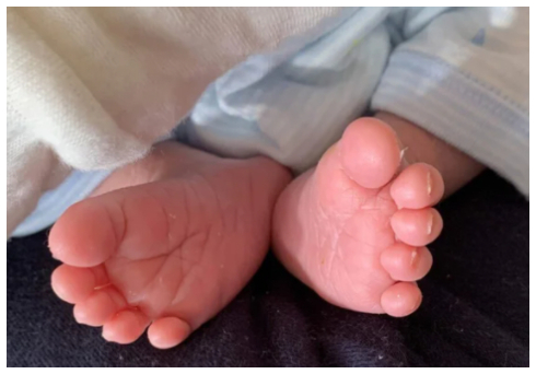 高畑百合子 パラリンピック ホッケー 堀江航 流産 出産 結婚 不妊治療 高齢出産