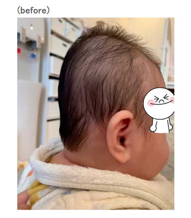 トレンディエンジェル 斎藤司 しゃん 妻 子ども 長男 息子 頭 絶壁 ヘルメット矯正 ゆがみ