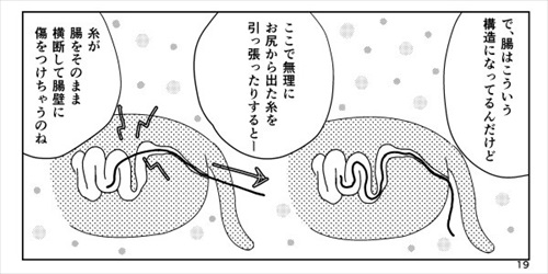 猫の尻からヒモが出た