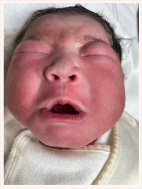 でっぱりん あいのり 出産 大量出血 妊娠 ヤス 夫 ブログ