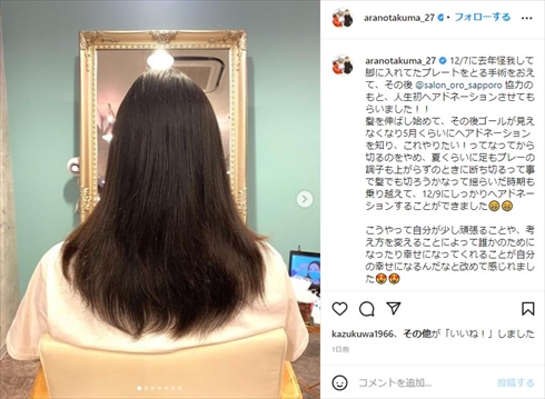 荒野拓馬 ヘアドネーション 北海道コンサドーレ札幌 Jリーグ ケガ インスタ