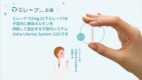 稲垣早希 ミレーナ 避妊リング 子宮内膜症 惣流・アスカ・ラングレー ものまね 新世紀エヴァンゲリオン ブログ