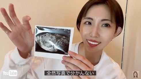 菊池瑠々 夫 妊娠 子ども 4人目 年の差
