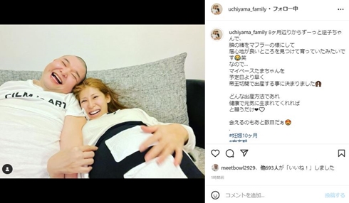 内山信二 内山琴 出産 帝王切開 逆子 いつ