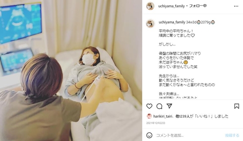 内山信二 内山琴 出産 帝王切開 逆子 いつ