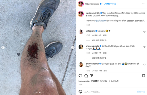 トラヴィスのケガ