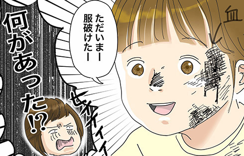 「あなたは生傷の絶えない子だったから…」　子ども時代の遊びを振り返る漫画がエクストリームすぎて冷や汗が垂れる