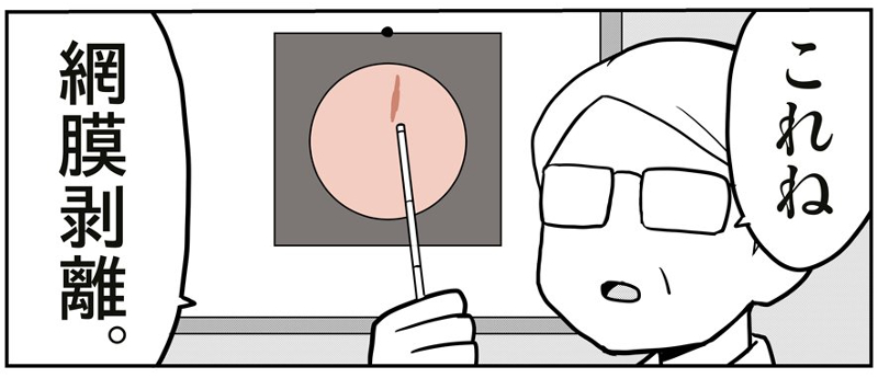 医師「これね、網膜剥離」　視界にゴミのようなものがたくさん、眼科で衝撃の診断を受けた実体験漫画に反響