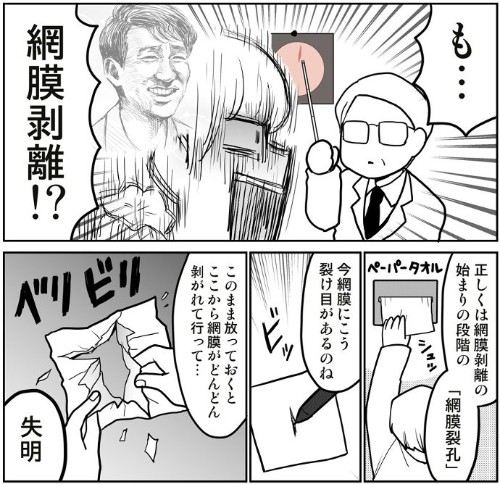 飛蚊症から網膜剥離