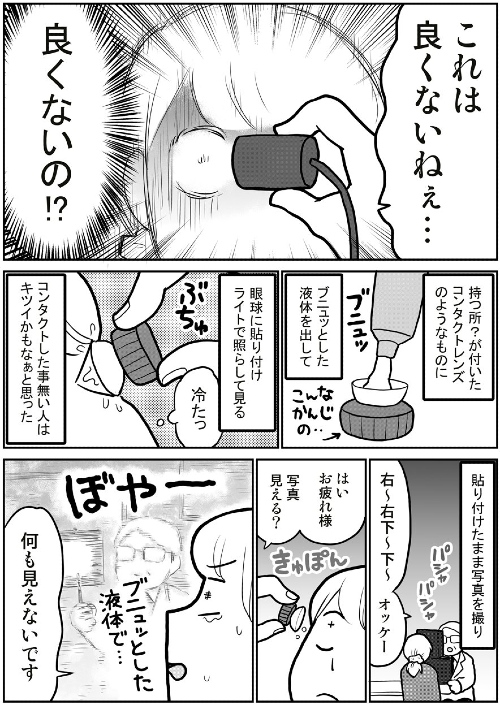 飛蚊症から網膜剥離