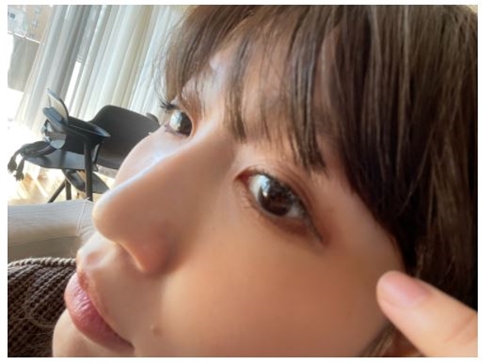 奥二重の線が再び出現した桃