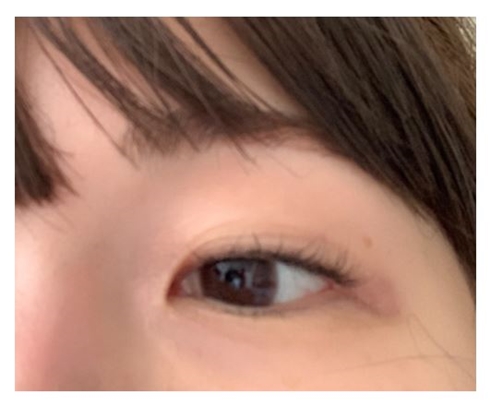 埋没がほぼ取れてきた桃