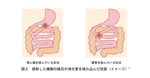 消費者庁による対処法