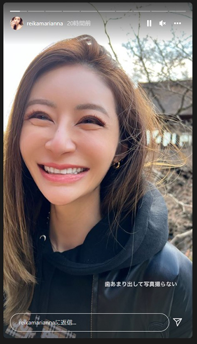 整形を勧められるきっかけとなった宮崎麗果の写真