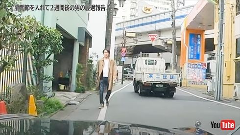 術後の千原ジュニア