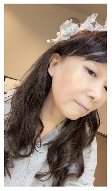 火傷した直後のアグネス・チャン