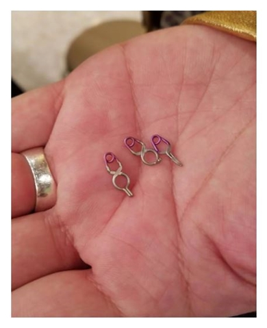 DJ KOOの脳動脈瘤のクリップ