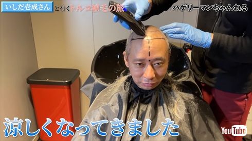 トルコで植毛手術を受けるいしだ壱成