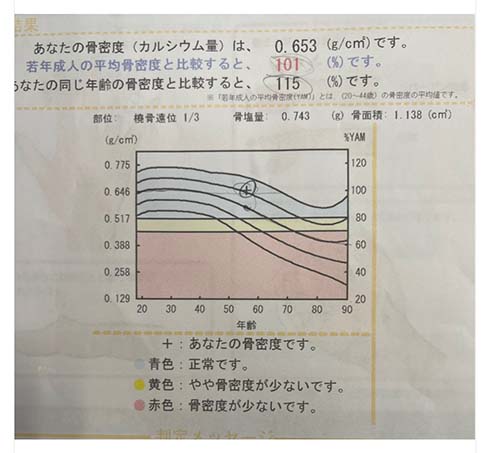 へバーデン結節と手根管症候群が判明した古村比呂