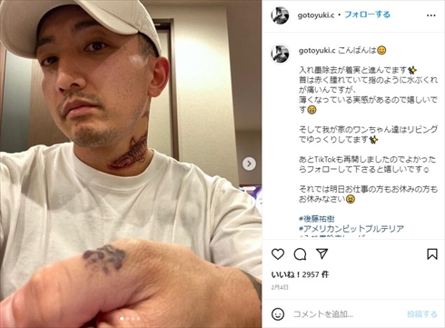 後藤祐樹のタトゥー除去