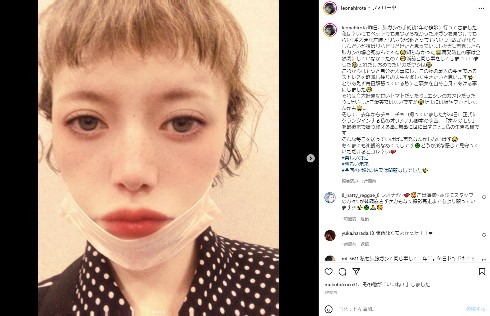 肺がんの手術から1年が経過したことを伝える広田レオナ