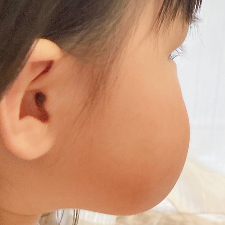 もちもちのほっぺのアップ