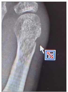 秋野暢子のレントゲン写真