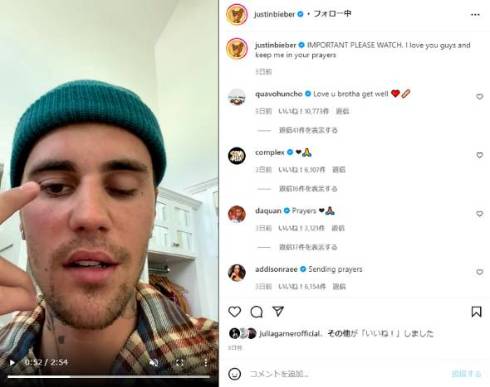 顔面まひを公表するジャスティン・ビーバー