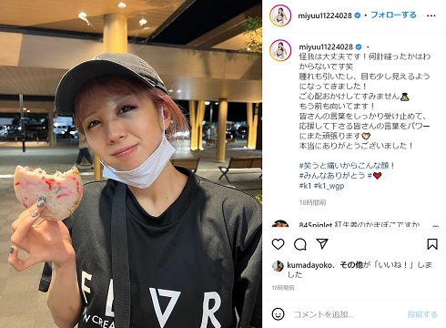 眉間のケガの経過を報告する菅原美優