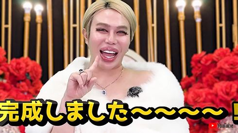 前歯の再施術を無事完了した整形男子アレン