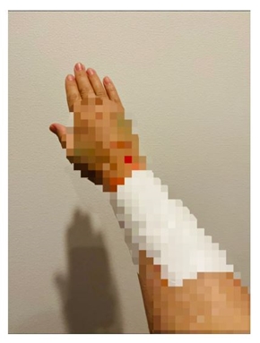 だいたひかるの術後